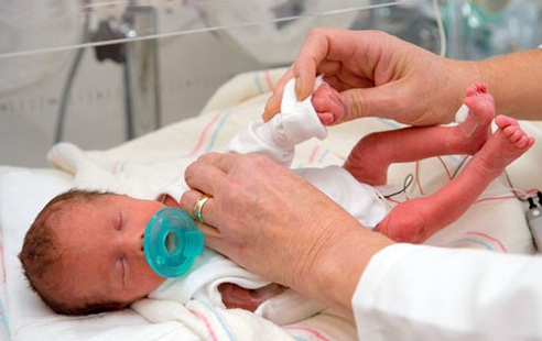 Premature Baby Pictures on Pre Term Babies At Higher Risk For Rare Form Of Hearing Loss