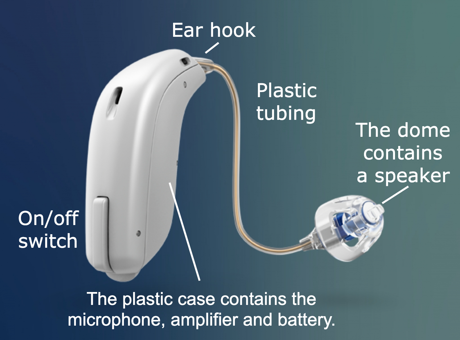 Understanding the parts of a hearing aid