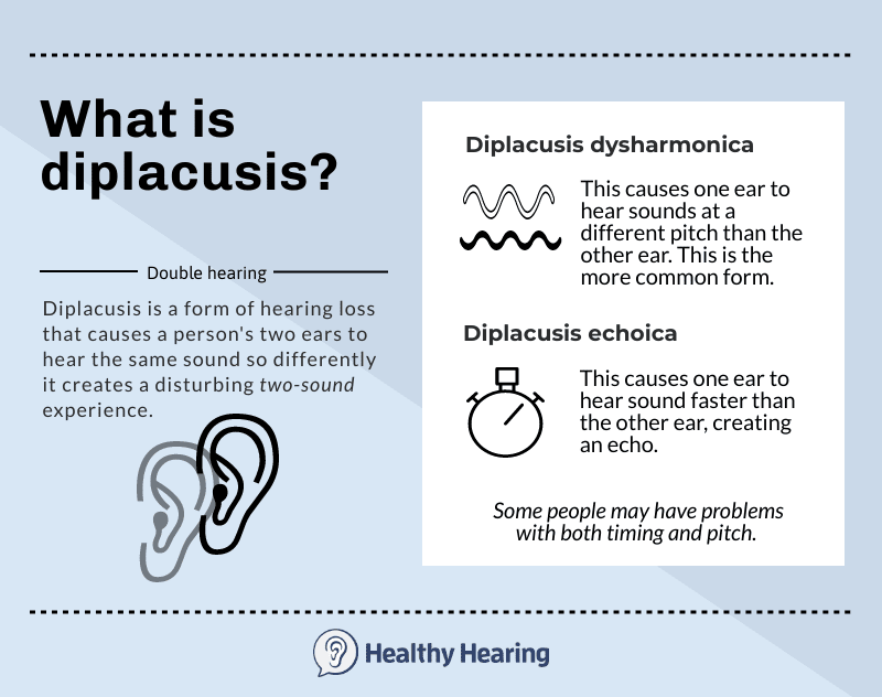 Understanding Different Types of Hearing Loss [Infographic]