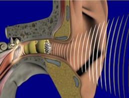 New technologies and binaural processing