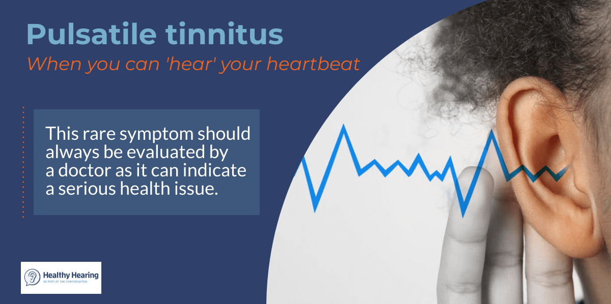 What does it mean if you can hear your heartbeat in your head?