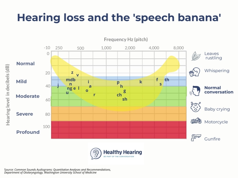 Audiogram showing the speech banana