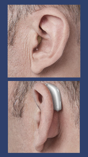Types Of Hearing Aids Hh19 Intheear 